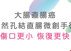 大腸直腸癌自然孔結直腸微創手術-傷口更小 恢復更快