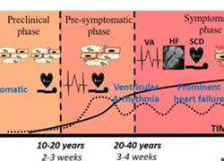 Pathogenesis of Arrhythmogenic Cardiomyopathy: Role of Inflammation