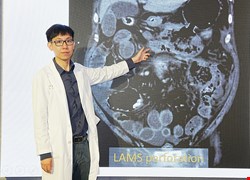小小膽結石恐引發壞死性胰臟炎 中醫大附醫多專科團隊合力逆轉重症 大幅提升存活率